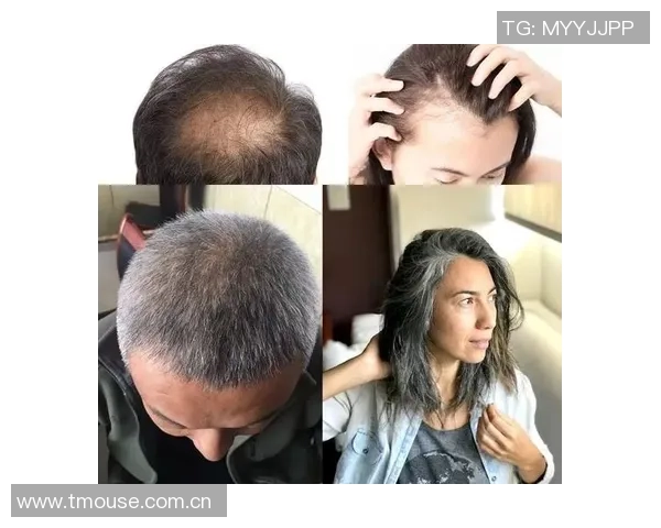 足球明星为何能保持浓密秀发揭秘背后的秘密与护发技巧